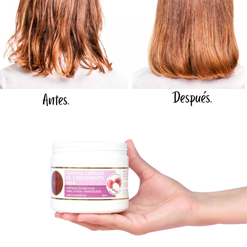 Terapia Capilar Cebolla Anyeluz - Imagen 4